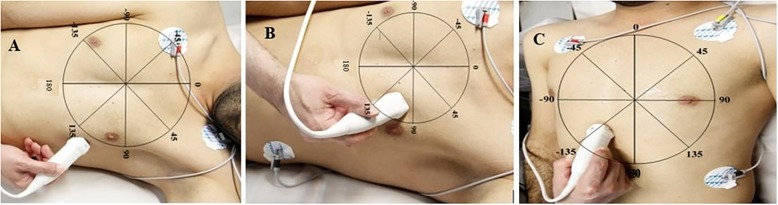 pocus_today's tweet photo. Transthoracic Evaluation of the SVC is difficult  - Description of 3 classical TTE windows here 👇
🔗https://t.co/pBJCY81LSN
#FOAMcc #FOAMed #MedTwitter #POCUS https://t.co/px3vFDzv7s