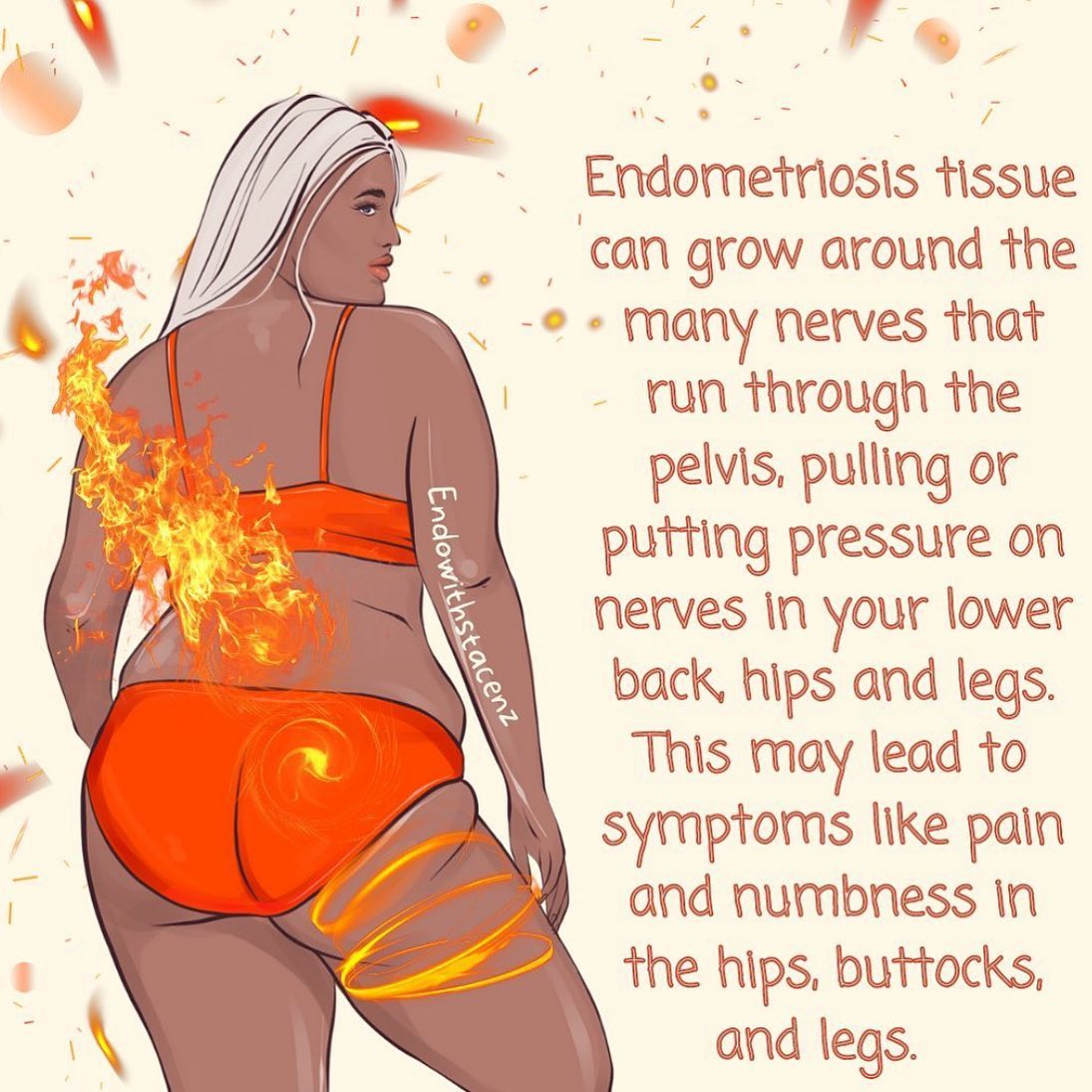“It’s painful.” 📷

#repost via @/endowithstacenz 📷

#endometriosis #chronicillness #nerves #symptoms
