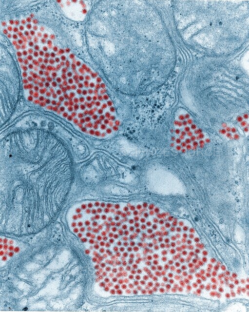 ScienceMagazine's tweet photo. An experimental antiviral drug can both prevent and treat infections in mice exposed to Venezuelan and eastern equine encephalitis viruses, two life-threatening pathogens that infect the brain. https://t.co/1uGdSUrEVu @ScienceTM https://t.co/BqpuxUPb8v