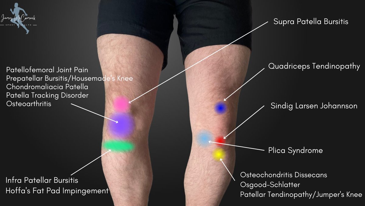 DIAGNOSIS OF KNEE PAIN

Credit: <a href="/Flawless_Physio/">James McCormack</a>