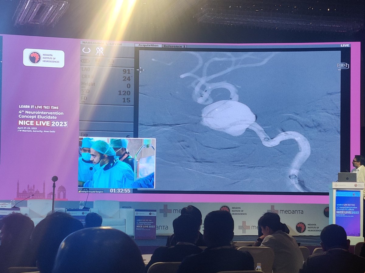 LIVE Case-7
Large ICA aneurysm - FD placement
-Dr Paritosh Pandey
#NICELive2023
#learnitlive
<a href="/drgauravgoel27/">Gaurav Goel</a> <a href="/Anshu__444/">Anshu Mahajan MD, DM, FINR</a> @anurag_mehndi <a href="/singh_trimaan/">Trimaan Singh</a> <a href="/mandaarw/">Mandar Waghralkar, MD DM FINR</a>
