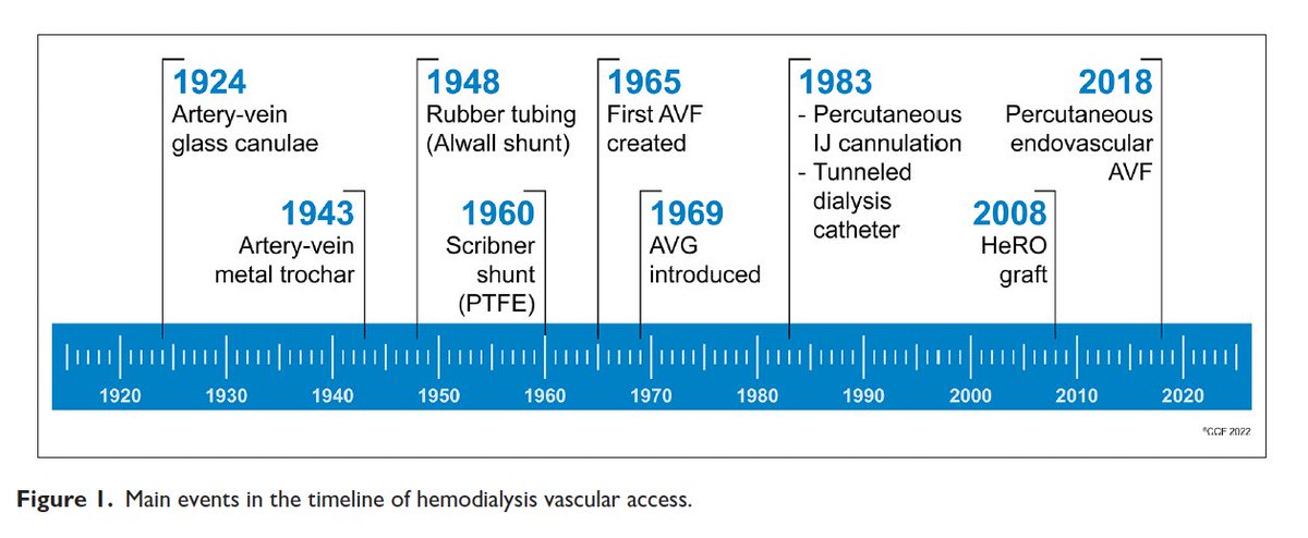 Happy to see our review article we started during fellowship finally published in the Journal of Vascular Access! 
“Global hemodialysis vascular access care: Three decades of evolution”
Link 👉🏽 journals.sagepub.com/doi/10.1177/11…
@tvachh @SiYuanKhor1 @SaynaNorouzi @Nora_hg