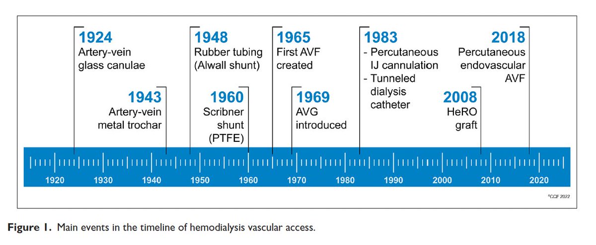 Mohamed H. Hassanein | محمد هشام حسنين 🇪🇬 (@kidneymo) on Twitter photo Happy to see our review article we started during fellowship finally published in the Journal of Vascular Access!
“Global hemodialysis vascular access care: Three decades of evolution”
Link 👉🏽 journals.sagepub.com/doi/10.1177/11…
<a href="/tvachh/">Tushar V (तुषार)</a> <a href="/SiYuanKhor1/">Si Yuan Khor</a> <a href="/SaynaNorouzi/">Sayna Norouzi, MD, FASN</a> @Nora_hg Happy to see our review article we started during fellowship finally published in the Journal of Vascular Access!
“Global hemodialysis vascular access care: Three decades of evolution”
Link 👉🏽 journals.sagepub.com/doi/10.1177/11…
<a href="/tvachh/">Tushar V (तुषार)</a> <a href="/SiYuanKhor1/">Si Yuan Khor</a> <a href="/SaynaNorouzi/">Sayna Norouzi, MD, FASN</a> @Nora_hg