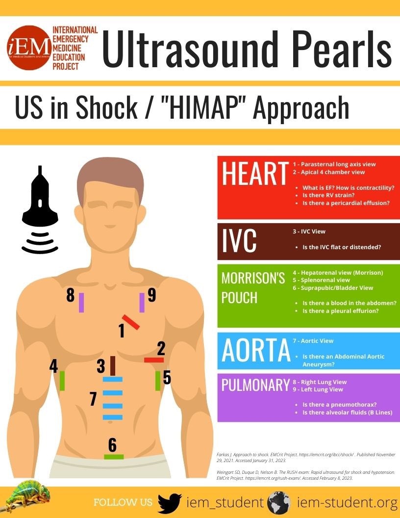 US in Shock - HIMAP approach