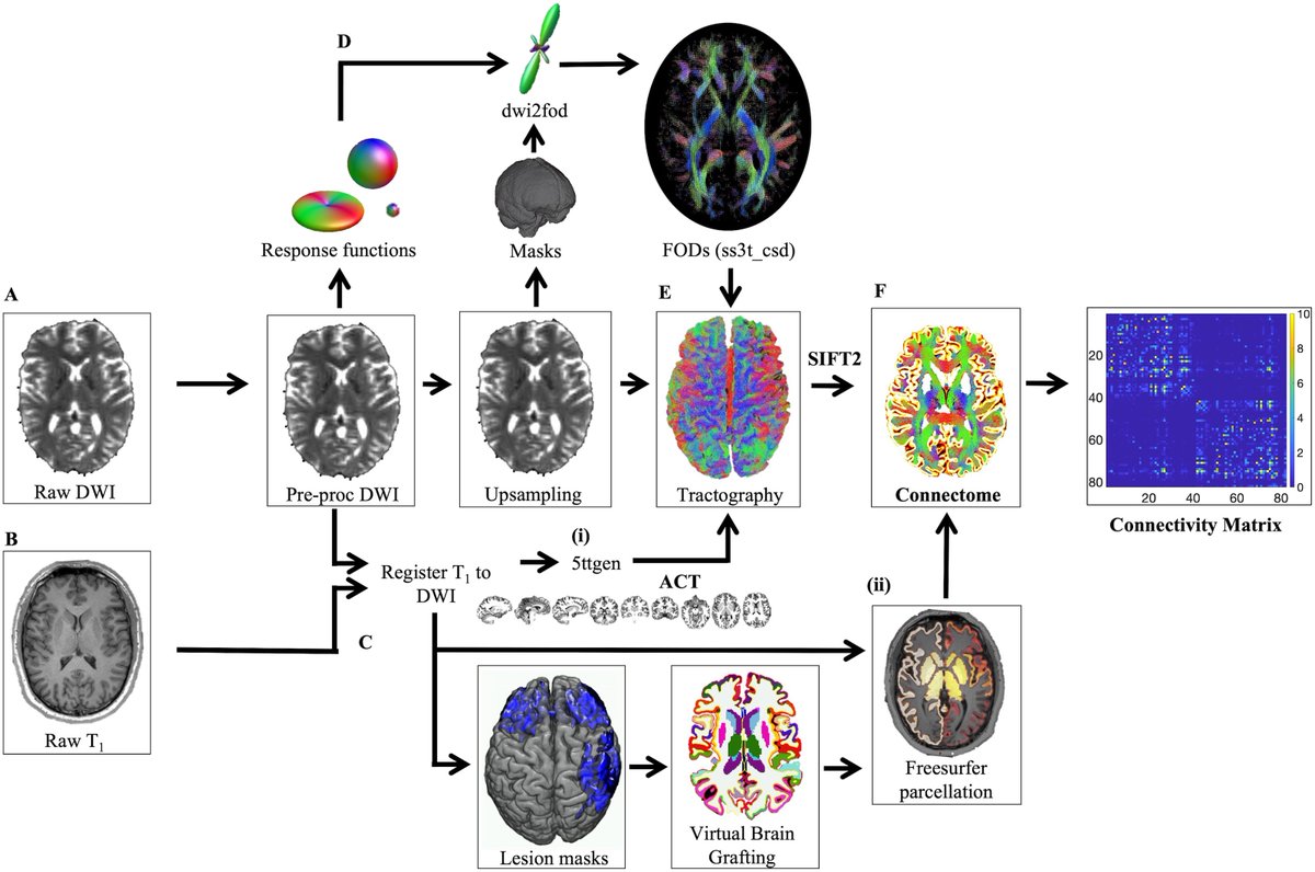 Network Neuroscience (@netneurosci) on Twitter photo Network Neuroscience (2023) 7 (1): 160–183.
Exploring personalized structural connectomics for moderate to severe traumatic brain injury
direct.mit.edu/netn/article/7…
<a href="/PhoebeImms/">Phoebe Imms</a> <a href="/KCaeyenberghs/">Karen Caeyenberghs</a> Network Neuroscience (2023) 7 (1): 160–183.
Exploring personalized structural connectomics for moderate to severe traumatic brain injury
direct.mit.edu/netn/article/7…
<a href="/PhoebeImms/">Phoebe Imms</a> <a href="/KCaeyenberghs/">Karen Caeyenberghs</a>