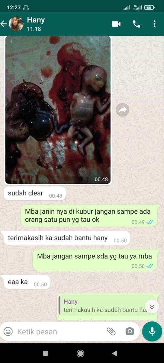 Kamasutra992's tweet photo. OBAT ABORSI !!
OBAT TELAT BULAN !!
OBAT PENGGUGUR KANDUNGAN. PALING AMPUH DAN CEPAT TUNTAS!!!
MINAT ORDER WA 0812-2662-1415 https://t.co/JIeBvPXC4U