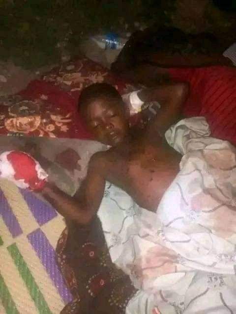 Afar children are still dying by z bombs that were installed by the tplf during their war on Afar pastoralists.
#attention4kasagita 
#Afar 
<a href="/AbiyAhmedAli/">Abiy Ahmed Ali 🇪🇹</a> 
<a href="/RedwanHussien/">Redwan Hussien</a> 
@walta_info 
<a href="/WHOEthiopia/">WHO Ethiopia</a> 
<a href="/awolarba/">Awel Arba</a> 
<a href="/EPHIEthiopia/">Ethiopian Public Health Institute</a> 
<a href="/mfaethiopia/">The Ministry of Foreign Affairs of Ethiopia 🇪🇹</a> 
<a href="/DemekeHasen/">Demeke Mekonnen Hassen🇪🇹</a> 
<a href="/FMoHealth/">Ministry of Health ETHIOPIA</a>