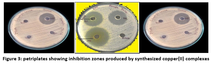 Orienjchem's tweet image. Synthesis, Spectral, Antimicrobial and In Vitro Antitumorous Studies of Copper Based Mulltidentate Thiosemicarbazones.
bit.ly/3KtZO8A
#Antitumorousstudies #Coppercomplexes #EPRspectra #gvalues #multidentate #chemistry #biochemistry #nanomaterial #analyticalchemistry