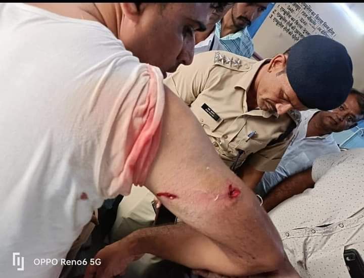 Dholpur Police (@dholpurpolice) on Twitter photo "राजस्थान पुलिस के पराक्रम पर अभिमान है।"
चूरु पुलिस के कानि. श्री रमेश मीणा की बहादुरी और साहस को सलाम है, श्री रमेश ने कंधे में गोली लगने के बावजूद सुजानगढ ज्वैलरी शॉप पर फायरिंग करने वाले अपराधी को धर दबोचा और अपने ज़ख्मी हाथ से उसे घसीट ले गए|
<a href="/RajsamandPolice/">Rajsamand Police</a>
<a href="/IgpBharatpur/">Bharatpur Range Police</a> "राजस्थान पुलिस के पराक्रम पर अभिमान है।"
चूरु पुलिस के कानि. श्री रमेश मीणा की बहादुरी और साहस को सलाम है, श्री रमेश ने कंधे में गोली लगने के बावजूद सुजानगढ ज्वैलरी शॉप पर फायरिंग करने वाले अपराधी को धर दबोचा और अपने ज़ख्मी हाथ से उसे घसीट ले गए|
<a href="/RajsamandPolice/">Rajsamand Police</a>
<a href="/IgpBharatpur/">Bharatpur Range Police</a>