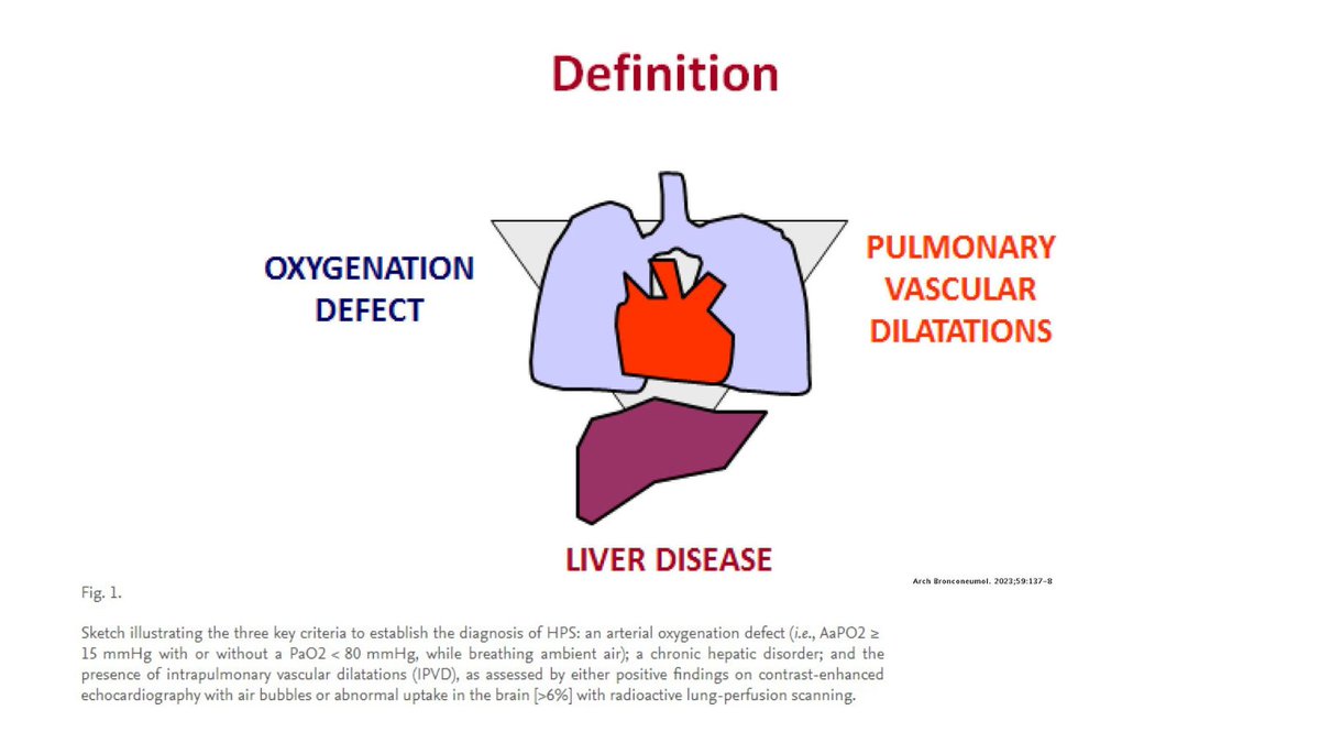 ArchBronconeumo's tweet photo. Hepatopulmonary Syndrome: A Forgotten Liver-induced Lung Vascular Disorder, an editorial by Robert Rodríguez Roisin.
🔗 Find it here: https://t.co/ZU8kLpAPx6
#SEPARrespira #BronconeumologyArchives
@SeparRespira @ArchBronconeumo https://t.co/Tqg7WVTAiS
