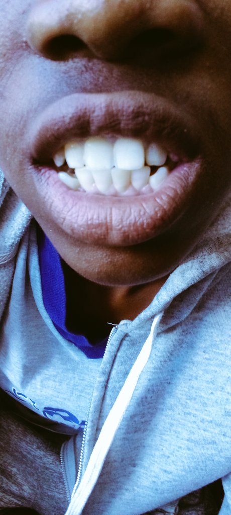 TeethJoel's tweet photo. https://t.co/MjzEagRPsl