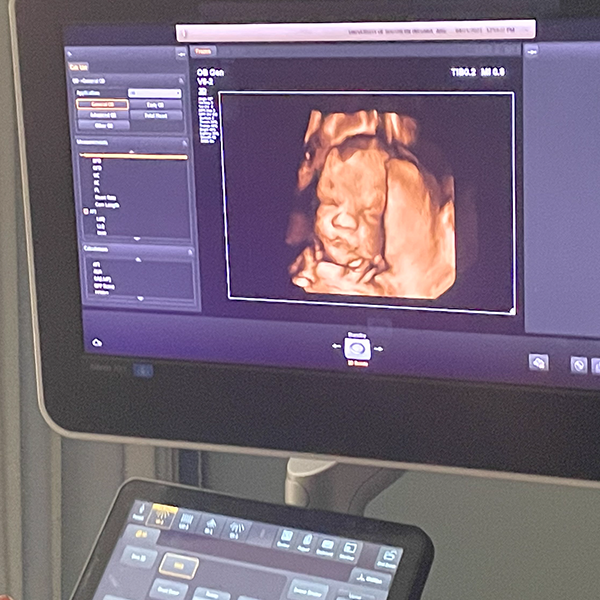 Oh baby! Congratulations to Amy Wilson, Chair of Diagnostic Medical Sonography, and Dr. Katherine Peak, Clinical Assistant Professor, for receiving the CNHP 2023 Faculty Development Award, which they used to purchase a 3D/4D transducer for students to use in our ultrasound lab.