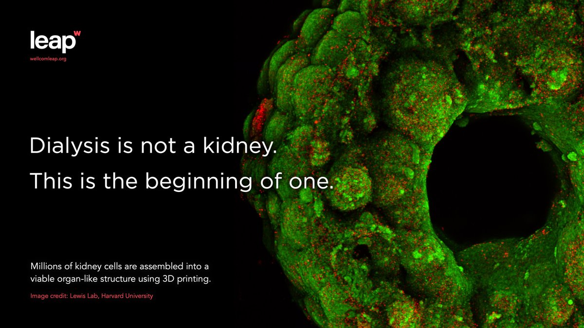 More than 90,000 Americans are waiting on a transplant list for a lifesaving kidney. What if we could print one? At Wellcome Leap, we see a future with no waiting lists — and more hope. bit.ly/3KQDF4v #DonateLifeMonth #DonateLife