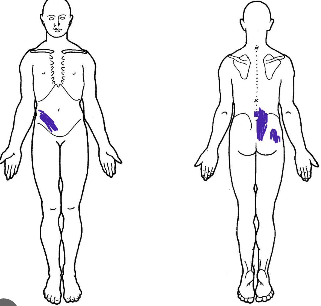 RedefineConEd's tweet photo. Things to consider with back pain that isn’t improving 🧵
This is (was) my body chart with my #endometriosis, occasionally extending diffusely into my R hip and following L4/S1 distribution down my R leg. The RLQ component was only there sometimes. https://t.co/PLyG9ifO9S