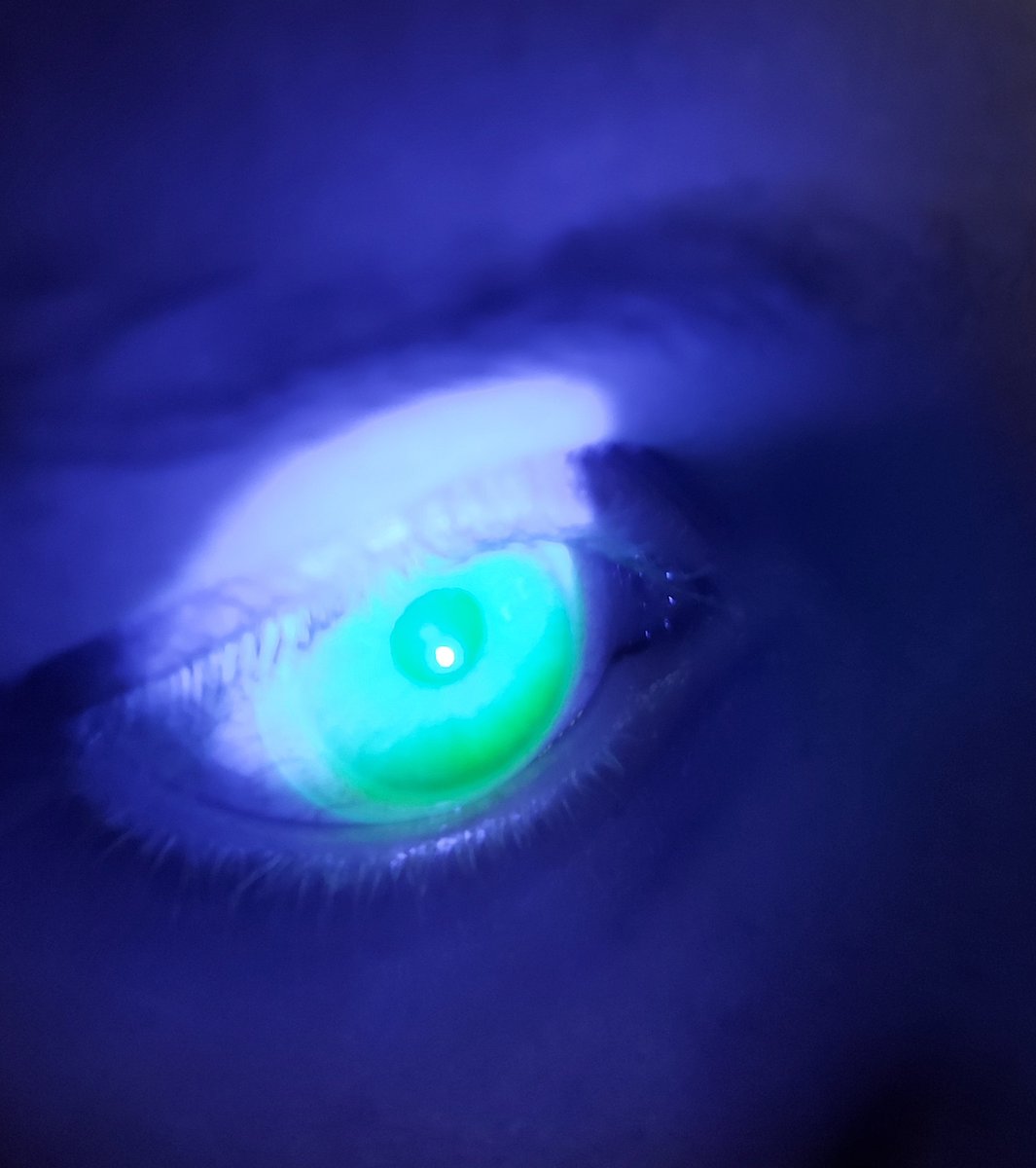 mrj_vision's tweet image. This week we had a session on mini-scleral lenses from @MeniconUK for our final year @PlymOptometry students. It was great to see their enthusiasm and skill to fit and assess the lenses.
Thanks to Josie, James and Hans from @Meniconuk for running these sessions.