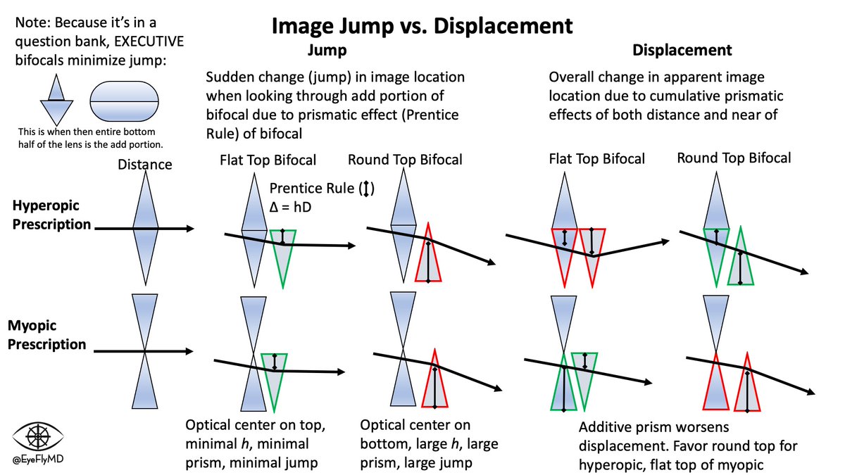 EyeFlyMD's tweet photo. Image jump and displacement also gave me a lot of trouble at first. @EyeDentistAAO has a great set of slides explaining it in detail but here is my quick summary.
#ophthalmology #ophthotwitter #medtwitter https://t.co/m4QqShoFiB
