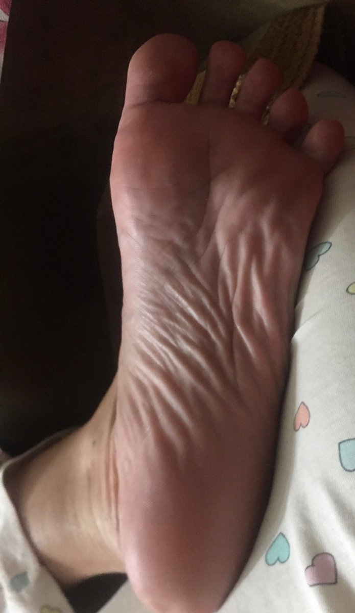 Violeta0843408's tweet photo. Alguien dispuesto/a leer las líneas del pie?? Buenas noches😘😉😴
#feetfethish 
#feetcontent 
#feet https://t.co/LbEh1jE3w5