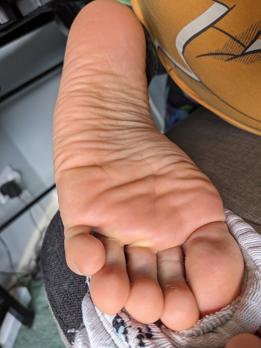 toesquish's tweet photo. peachy sole wrinkles https://t.co/CTGZRFNMqd