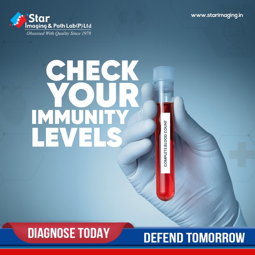 StarImaging_'s tweet image. Boost your confidence, not just your immune system 💪✨ Get your immunity level checked at Star Imaging and Path Labs! 🌟🔬 #StarImaging #PathLabs #ImmunityCheck #HealthWarrior #KnowYourStrength #ImmunityMatters #StayHealthyStayStrong