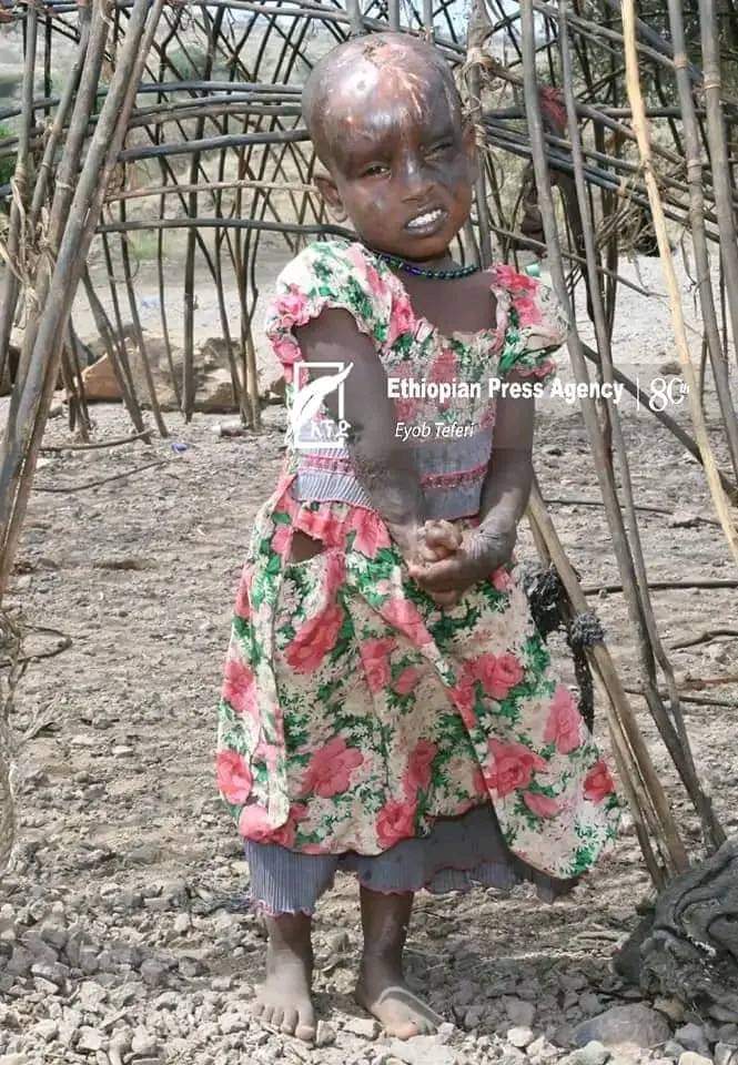 ErerKee's tweet photo. Our Children have the right to a safe place to live and to be protected from abuse and harm.

#attention4kasagita 
#kasagita #Afar https://t.co/gw4DdmINQI