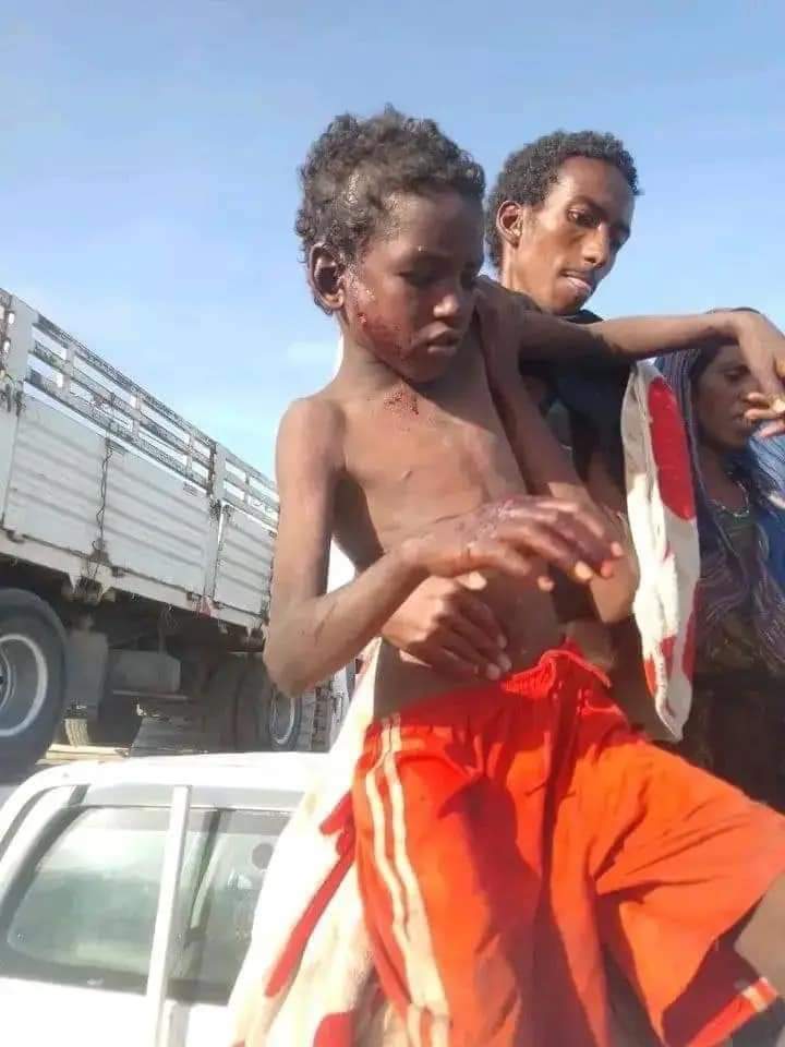 ErerKee's tweet photo. Our Children have the right to a safe place to live and to be protected from abuse and harm.

#attention4kasagita 
#kasagita #Afar https://t.co/gw4DdmINQI