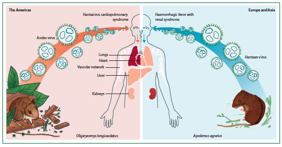 virushanta's tweet photo. Espectacular paper en @LancetMicrobe  revisa aspectos clínicos de la enfermedad causada por #hantavirus en América, Europa y Asia. Tremenda colaboración  de científicos de Chile, Suecia y USA  @InvestigaUDD @UDD_FM @ucatolica @FacMedicinaUC @karolinskainst @umeauniversity @UNM https://t.co/whmmskRp20
