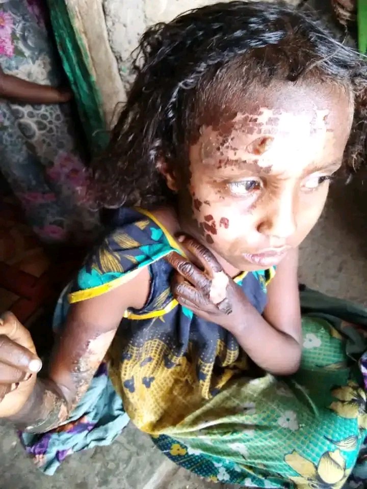 ErerKee's tweet photo. We argue Ethiopian government to take action on UXOs, and launch an investigation in those tragic incidents happening in daily basis in #kasagita and hold those responsible accountable for their irresponsible actions. 
#Kasagita https://t.co/PBFCh2Ykl4