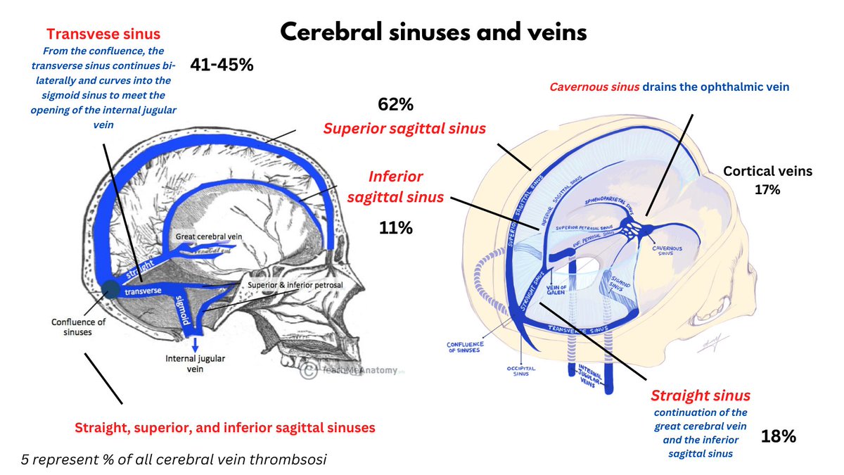 1 8 cerebral vein thrombosis cvt saw a 34 yo f who presented with