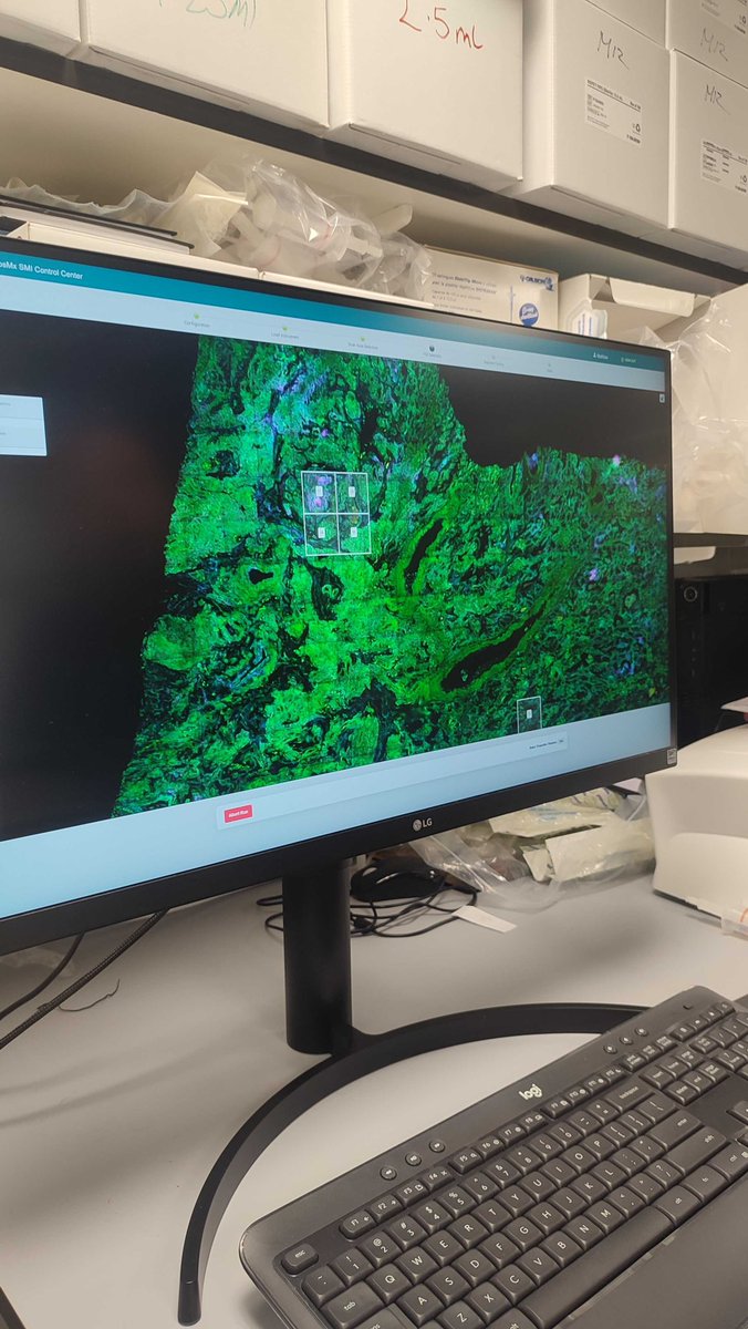 LabSpatialNBJ's tweet image. We are very very VERY excited to be running #cosmx #singlecell #spatialtranscriptomics experiments in @UofGlasgow @UofGCancerSci @UofGMVLS 

Well done to the @LabSpatialNBJ team 

@nanostringtech