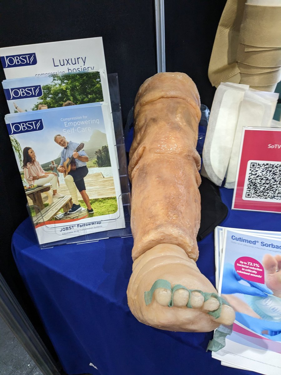 EmmaOcasey22's tweet photo. Would like to say a massive Thank You to @SoTV_UK for an amazing wound care conference - it's been such a privilege to attend as a student nurse and to expand my understanding of wound management. 
 A few photos from the conference #SOTV2023 https://t.co/RrUyxgQwqS