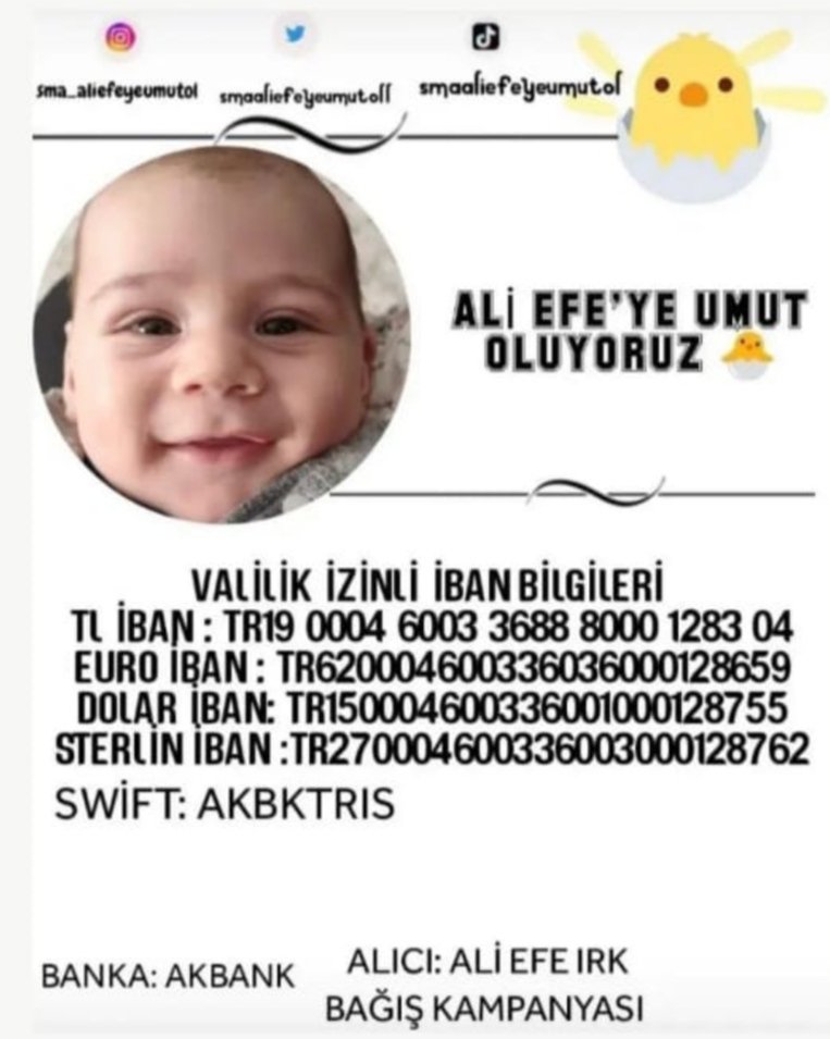 Sma lı yavrumuz,
Üyemiz Ebru Arıkan Akkaya'nın yeğenidir.
Yardım kampanyası Valilik onaylıdır.
Ebru hocamıza geçmiş olsun dileklerimizle,
Ali Efe'ye acil şifalar diliyoruz.
<a href="/tcmeb/">Millî Eğitim Bakanlığı</a> 
<a href="/prof_mahmutozer/">Mahmut Özer</a>
<a href="/Kamu_Sen/">Türkiye Kamu-Sen</a> 
<a href="/TalipGeylan06/">Talip Geylan</a> 
<a href="/Mardin_Valiligi/">Mardin Valiliği</a> 
<a href="/mardinilmem/">Mardin İl Millî Eğitim Müdürlüğü</a> 
<a href="/artukluilcemem/">Artuklu İlçe Milli Eğitim Müdürlüğü</a> 

#sma