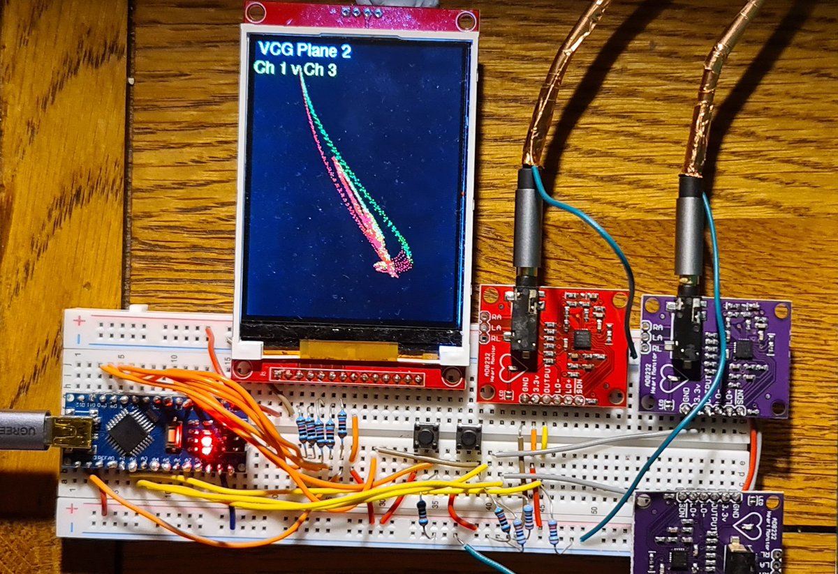 NeilGrubb's tweet image. Home made ECG / VCG - code for single lead, orthogonal 3 lead, and 3 VCG planes now integrated, with mode and freeze buttons - cost €30 to make !
#arduino #arduinoproject #adafruit #electronicsprojects #EKG #epeeps #arrhythmia #CardioTwitter #cardiology #bhrs #ehra #HRS2023