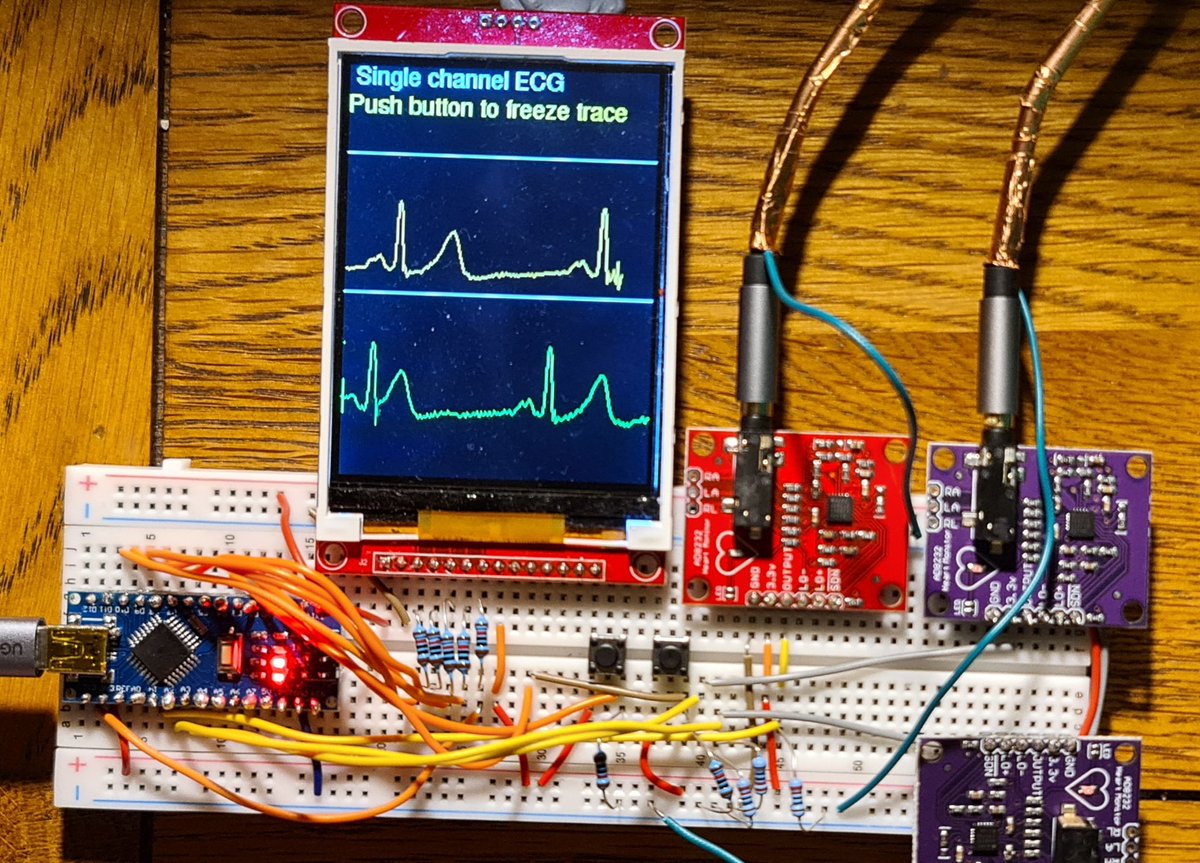 NeilGrubb's tweet image. Home made ECG / VCG - code for single lead, orthogonal 3 lead, and 3 VCG planes now integrated, with mode and freeze buttons - cost €30 to make !
#arduino #arduinoproject #adafruit #electronicsprojects #EKG #epeeps #arrhythmia #CardioTwitter #cardiology #bhrs #ehra #HRS2023