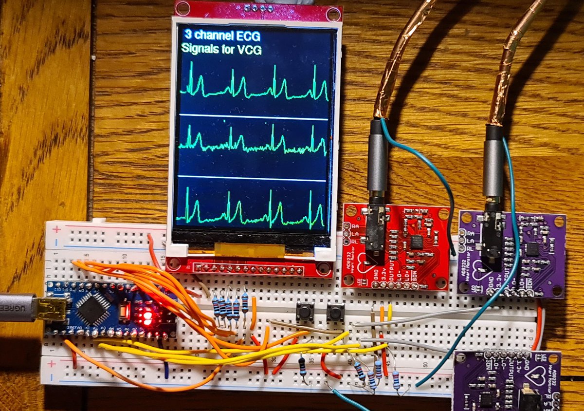 NeilGrubb's tweet image. Home made ECG / VCG - code for single lead, orthogonal 3 lead, and 3 VCG planes now integrated, with mode and freeze buttons - cost €30 to make !
#arduino #arduinoproject #adafruit #electronicsprojects #EKG #epeeps #arrhythmia #CardioTwitter #cardiology #bhrs #ehra #HRS2023