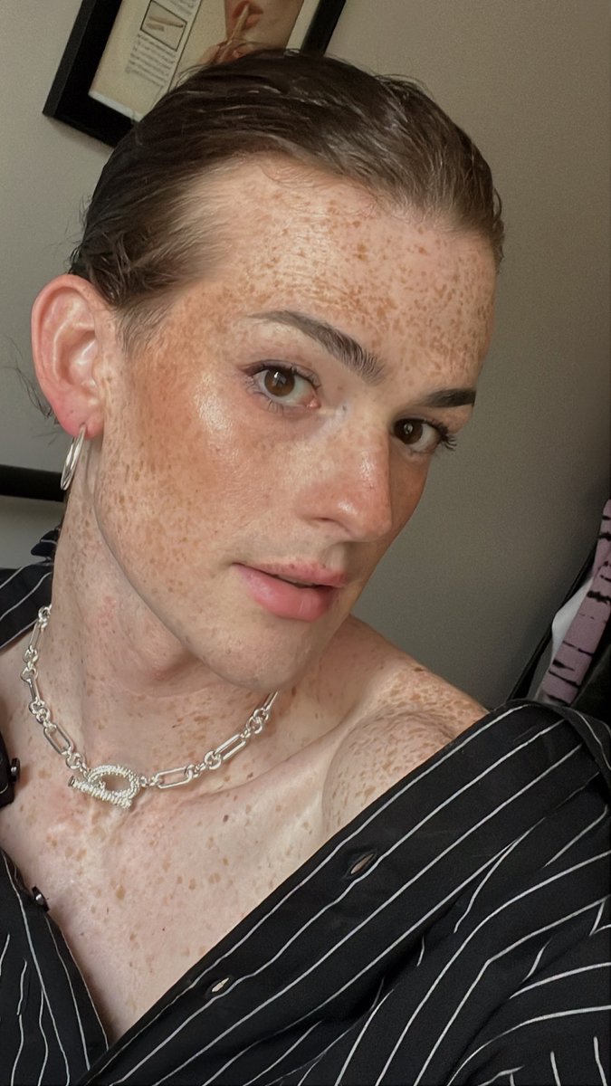 athensren's tweet photo. freckles were freckling today 🥺 https://t.co/xDKL4YCFsa