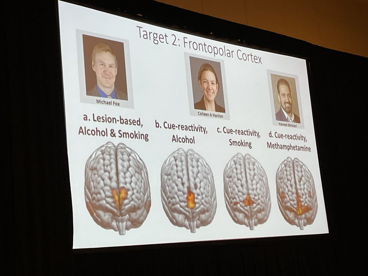 Michael Fox (@foxmdphd) on Twitter photo Great talk by <a href="/EkhtiariHamed/">Hamed Ekhtiari</a> showing convergent data identifying frontopolar cortex and a neuromodulation target for addiction. #SOBP2023 Great talk by <a href="/EkhtiariHamed/">Hamed Ekhtiari</a> showing convergent data identifying frontopolar cortex and a neuromodulation target for addiction. #SOBP2023