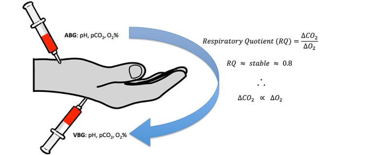 PulmCrit's tweet photo. Fresh IBCC chapter on ABG, VBG, &amp; pulse oximetry
💉Pulse oximetry is the default for assessing oxygenation, but it has numerous limitations
💉Peripheral VBG is fine for eval of pCO2 &amp; pH, unless the venous sat is crazy low
💉Don't forget end tidal CO2!
(https://t.co/7kXyCmm9YD) https://t.co/PHcSqsRpkl