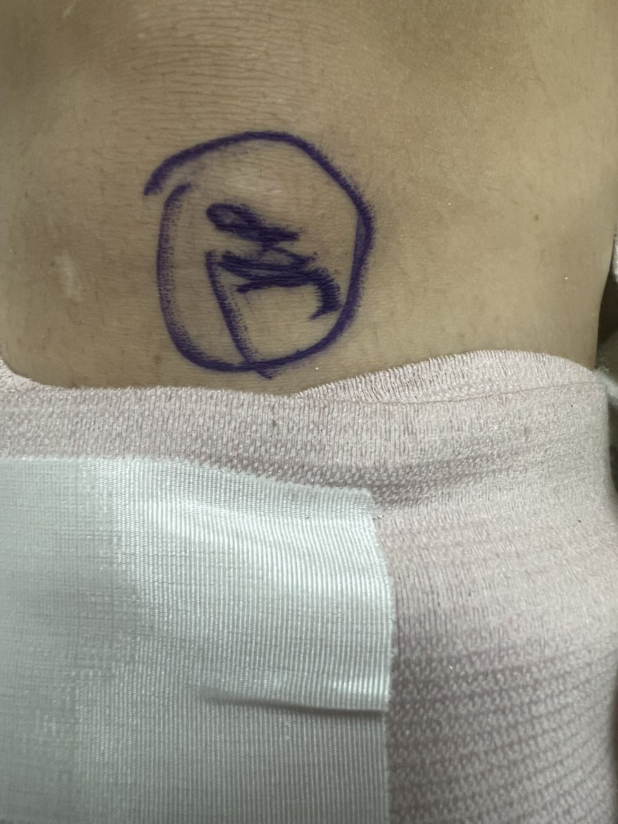 PedPrac12's tweet image. Marked 💪 It’s official #ToTheOR #Ortho #TibFib  Thank you for excellence !! #DrJamesParrish #ShawnCarrington #Natalia @RebeccaSaberi  Dr Monica Payares 
@RyderTraumaSCC @UMJMHSurgery