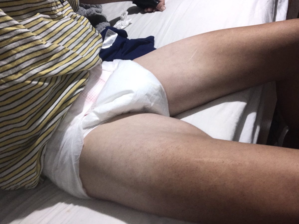 diaperboydan's tweet photo. Smooth skin, locked my small cock and padded up. 24/7 #abdl #diaperboy https://t.co/MzYdd02VBE