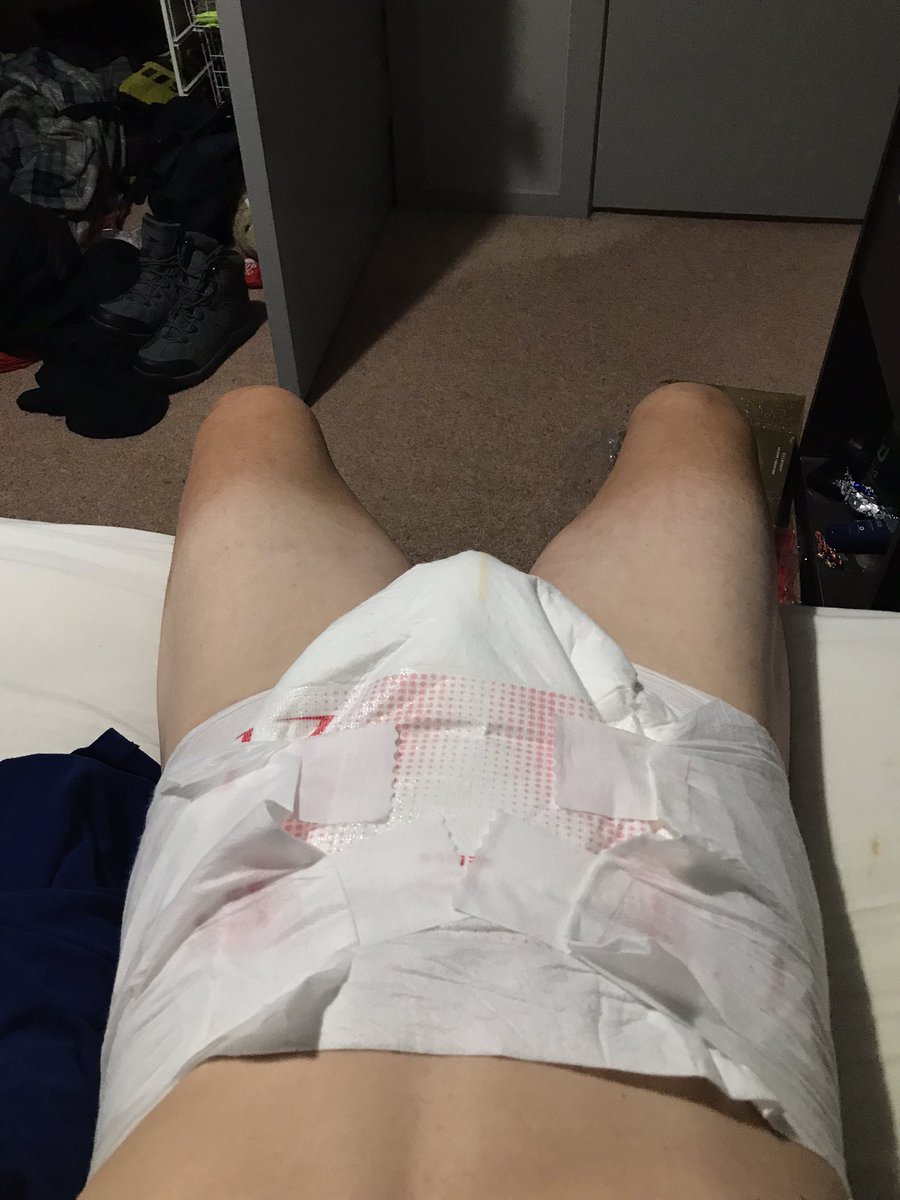 diaperboydan's tweet photo. Smooth skin, locked my small cock and padded up. 24/7 #abdl #diaperboy https://t.co/MzYdd02VBE