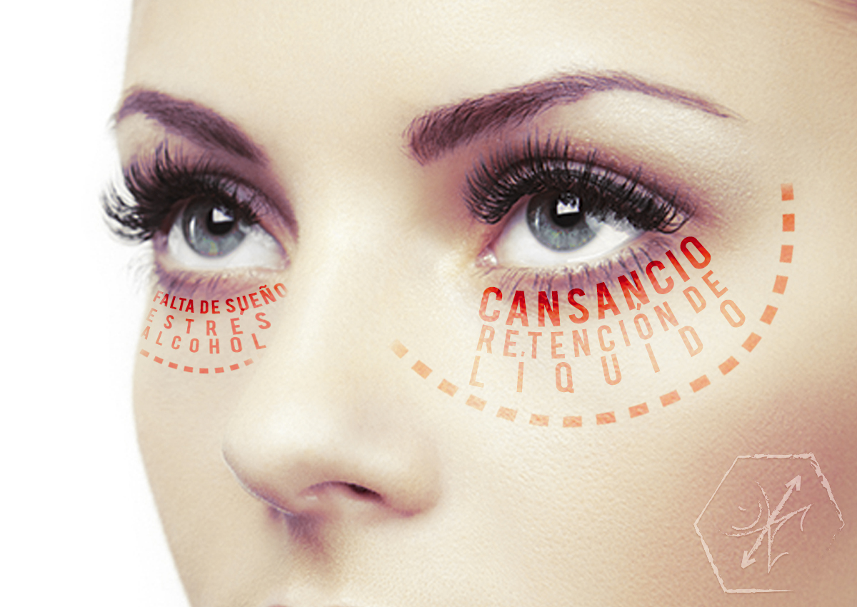 ¿Qué son las bolsas de los ojos? blgs.co/_3T4c2