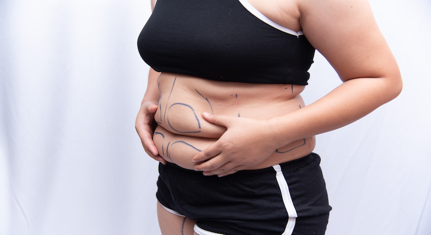 SecurityBuyer's tweet image. Sensitive plastic surgery photos exposed online 

#security #AmazonWebService #GeneralDataProtectionRegulation #NextMotion #NextMotionCEODrEmmanuelElard #vpnMentor @PittockJon

Read more here: securitybuyer.com/sensitive-plas…