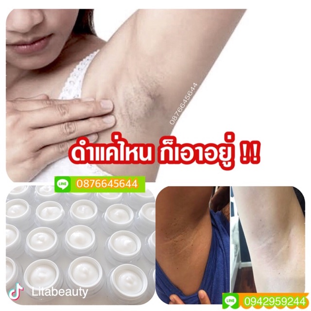 thelitabeauty's tweet photo. ฉันกำลังขาย 3วัน!!รักแร้ขาว|แก้รัก... ที่ Shopee ในราคาสุดพิเศษเพียง ฿159 ซื้อเลยที่ https://t.co/7Um1JYsBwN #ShopeeTH https://t.co/jHP5f97RbK