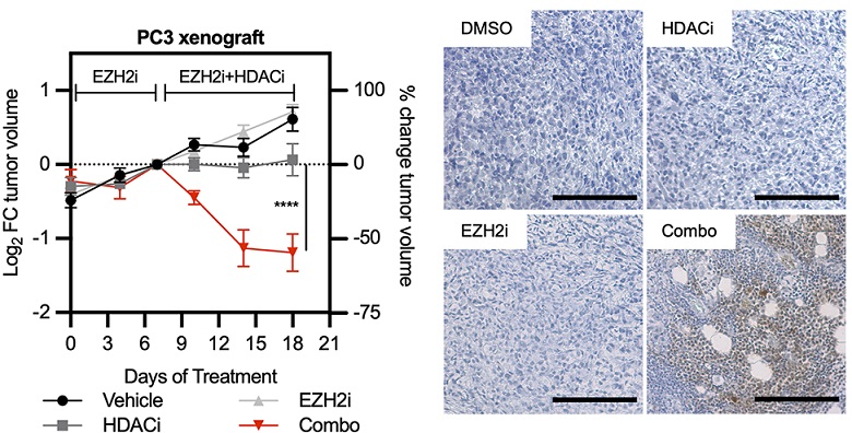 PLOSBiology's tweet photo. .@CichowskiLab shows that two major #epigenetic regulators (EZH2 & HDAC) buffer advanced #ProstateCancer from lethal stress responses, revealing a promising combination therapy for #CastrationResistant disease #PLOSBiology https://t.co/lsU0Hd2Fcf https://t.co/wMuXMywQuj