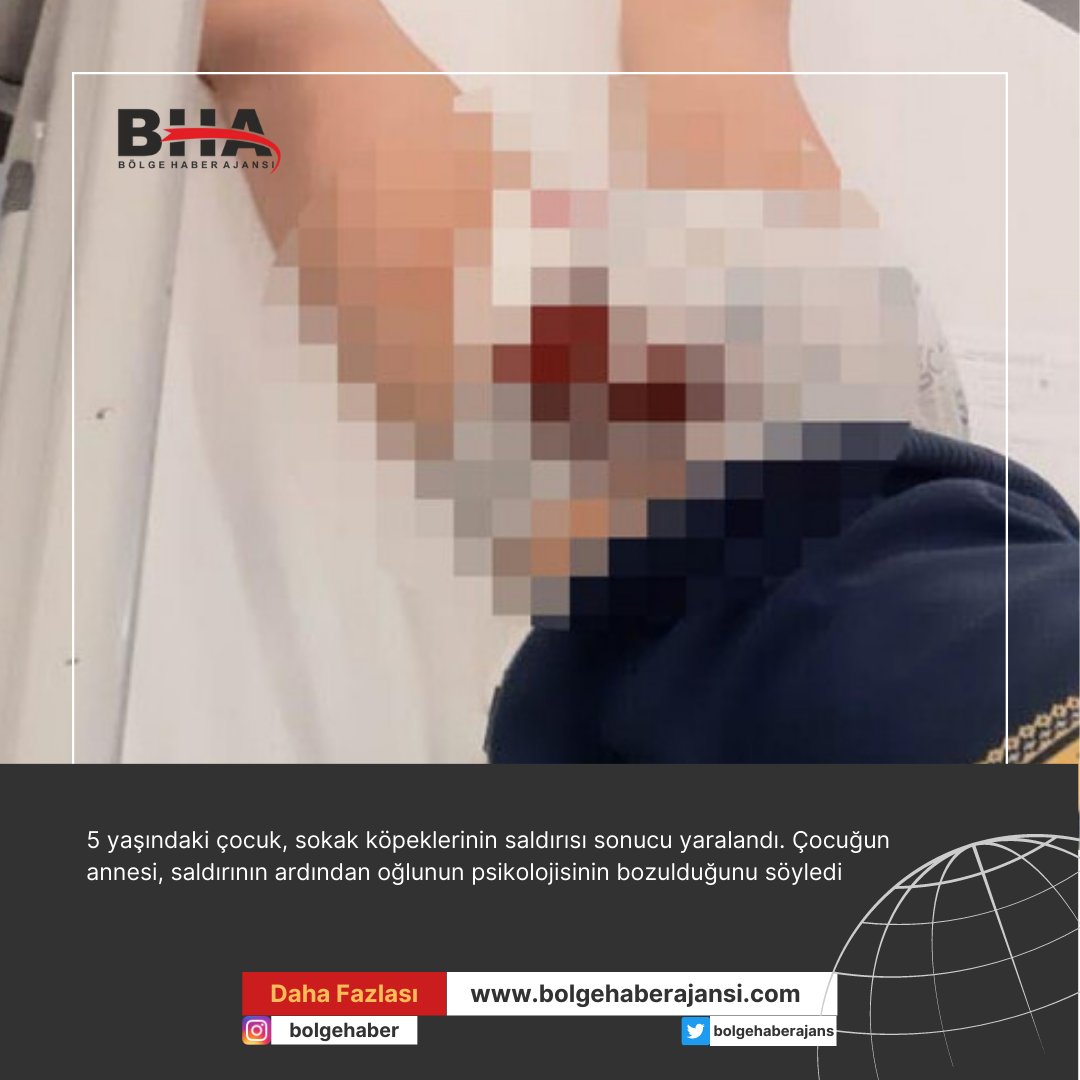 Ankara’da sokak köpekleri, 5 yaşındaki çocuğa saldırdı
#ankara #başıboş #köpek #saldırı #yaralama #haber #haberler #bölgeahaber