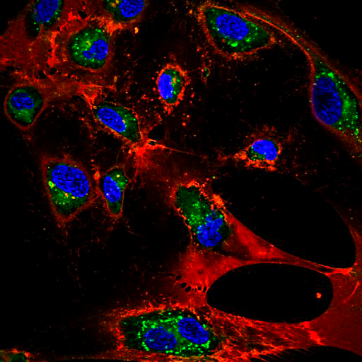 PLASTICHEAL (@plasticheal) on Twitter photo Nano-sized (less than 0.1 μm) #microparticles are also covered by the restriction, issued under the EU #chemical legislation #REACH.
The proposal follows <a href="/EU_ECHA/">European Chemicals Agency - ECHA 🇪🇺</a> findings that #microplastics pose a #environmental #risk that has not been adequately controlled.
Img: Juan Martin Nano-sized (less than 0.1 μm) #microparticles are also covered by the restriction, issued under the EU #chemical legislation #REACH.
The proposal follows <a href="/EU_ECHA/">European Chemicals Agency - ECHA 🇪🇺</a> findings that #microplastics pose a #environmental #risk that has not been adequately controlled.
Img: Juan Martin