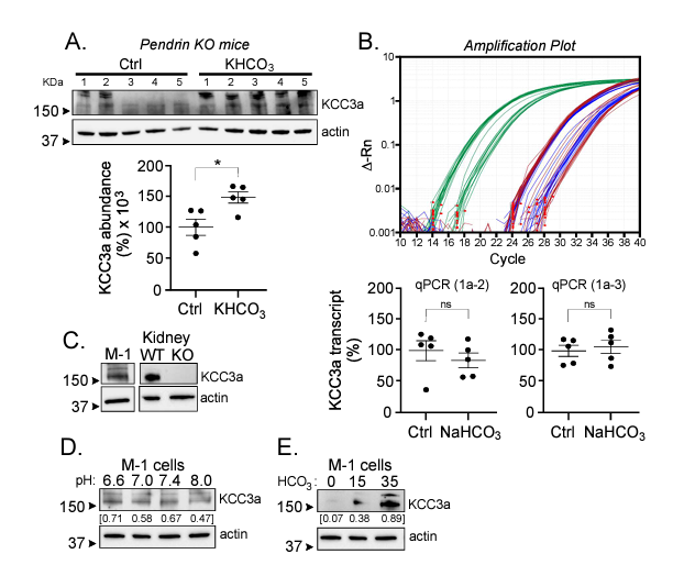 AJPCellPhys's tweet image. This Friday features an #AricleinPress and #RapidReport by Mohammed Ferdaus et al. titled, #Bicarbonate is the primary inducer of KCC3a expression in renal cortical B-type intercalated cells:

ow.ly/jJOg50NPgNT

@VUMChealth #Alkalemia #Pendrin