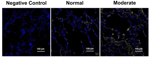 AJPLung's tweet image. Happy Friday! Today's #ArticleinPress is titled, The Relationship Between Elastin Crosslinking and Alveolar Wall Rupture in Human Pulmonary Emphysema (Michael Fagiola et al. @StJohnsU @YaleMedicine):

ow.ly/N3XJ50NPgFn

#Elastin #Alveolar #MassSpectrometry