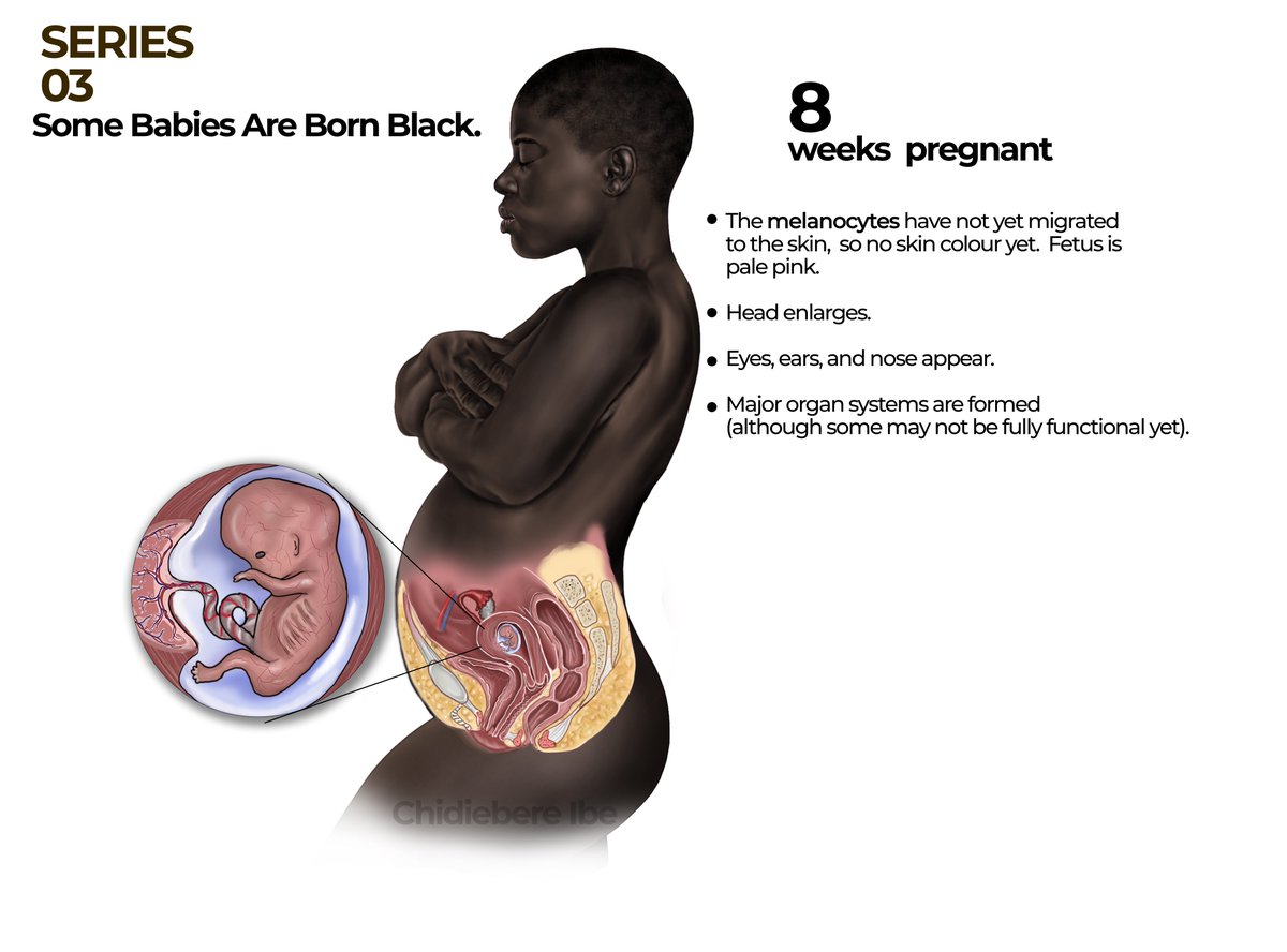 SERIES 03: Some Babies Are Born Black. 

Fetal development is a complex process and it varies from one individual to another. 

Follow me through this series. 

#onesizedoesnotfitall #blackmothers #representationmatters