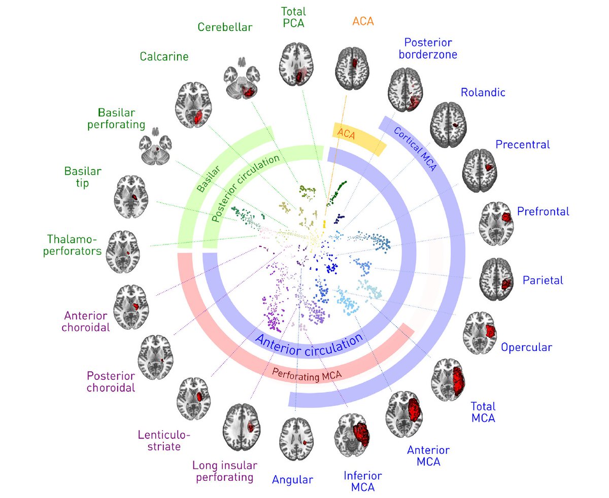 Reclassifying #stroke #lesion #anatomy via unsupervised #machine #learning.

Loved this work <a href="/UCLIoN/">UCL Queen Square Institute of Neurology</a> with <a href="/TianboXu/">Tianbo Xu</a>, <a href="/amypknelson/">Amy Nelson</a>, #RobertGray, <a href="/neuro_penguin/">Ashwani Jha</a>, #SebastienOurselin, <a href="/mjorgecardoso/">Jorge Cardoso</a>, <a href="/profgeraintrees/">Geraint Rees</a>, #HansRolfJäger &amp; #ParashkevNachev.